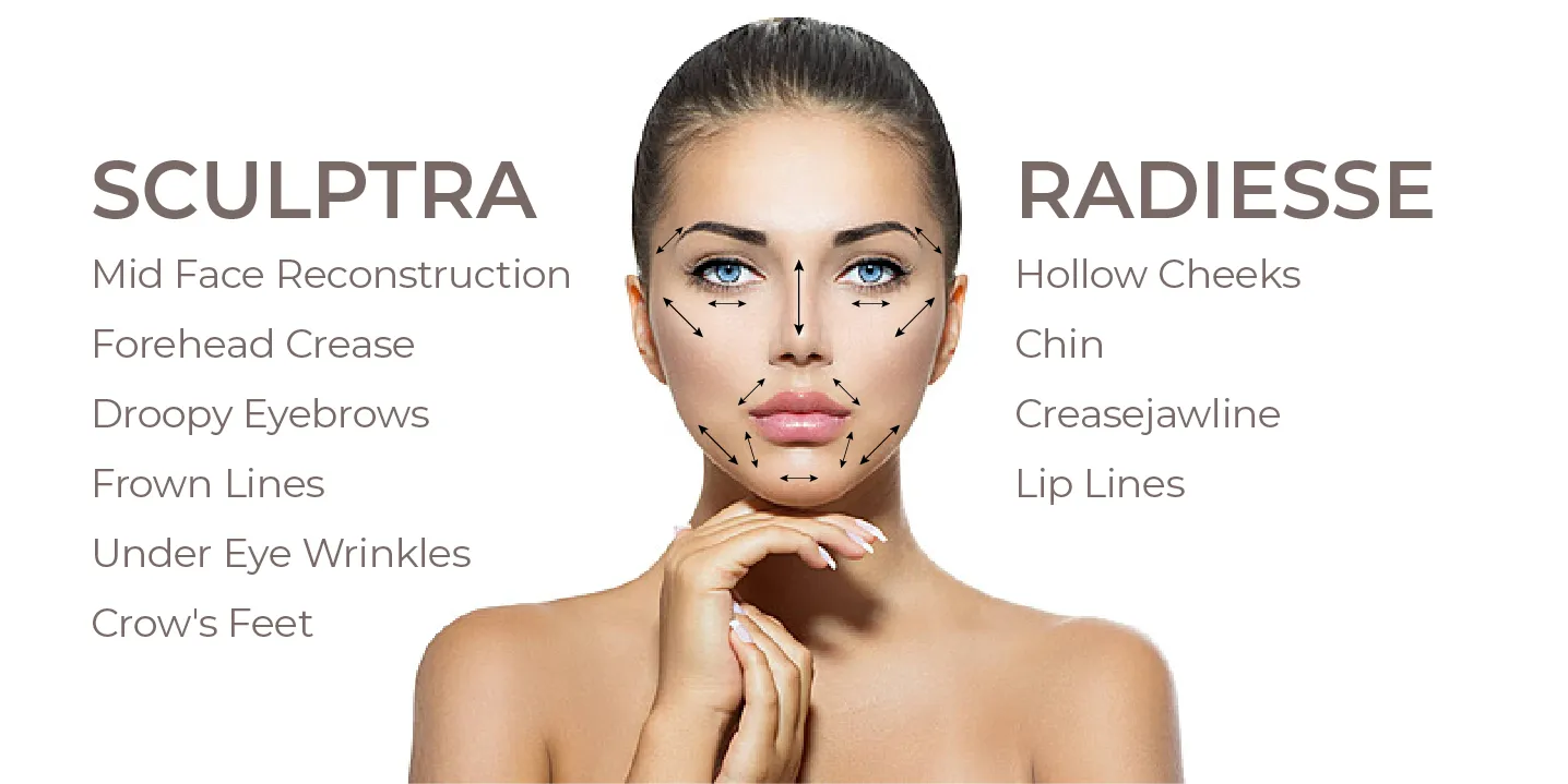 Sculptra And Radiesse